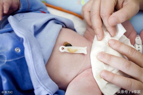 神奇的 脐贴 , 哪里痛了贴哪里