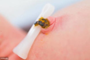 新生儿脐带护理你真的学会了吗？4大注意事项，新手爸妈请收藏